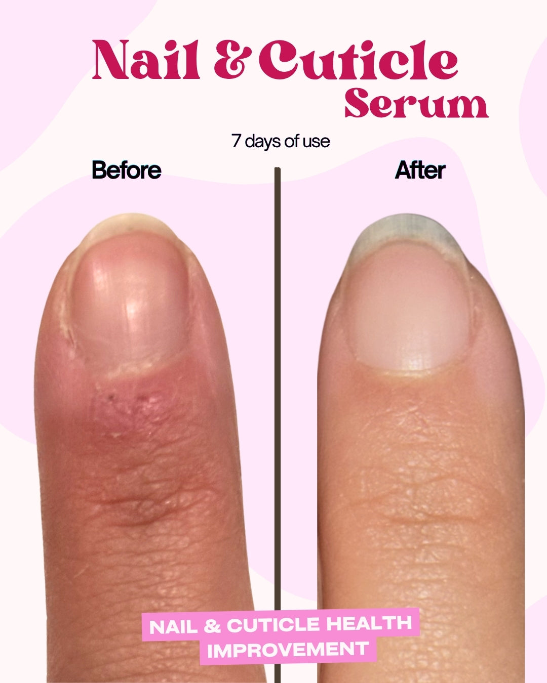 Nail & Cuticle Serum